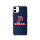 SPB iPhone Case