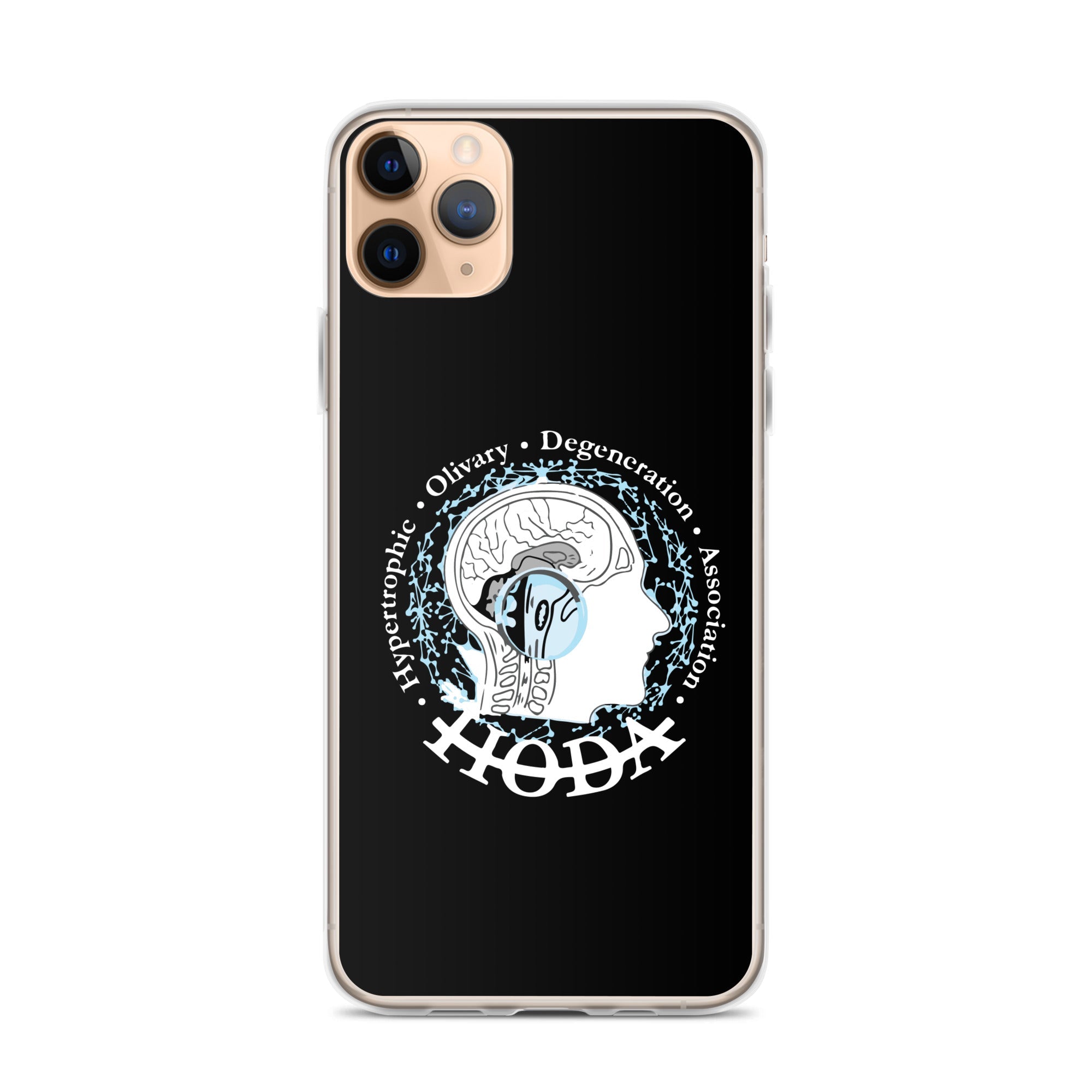 HODA Case for iPhone®