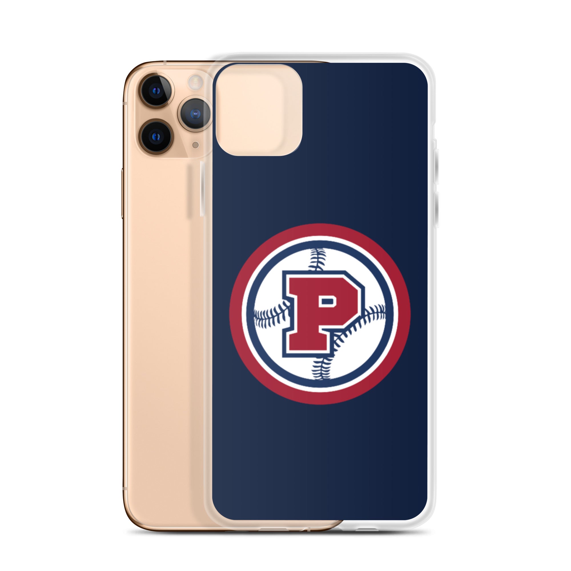 PAB iPhone Case