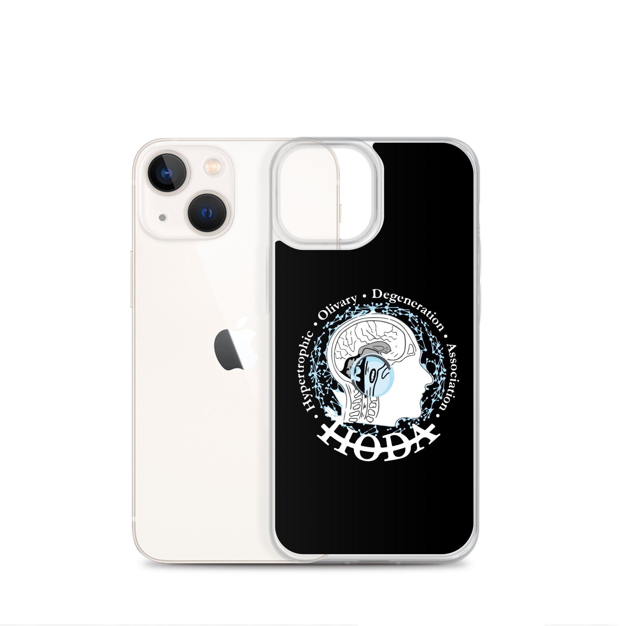 HODA Case for iPhone®