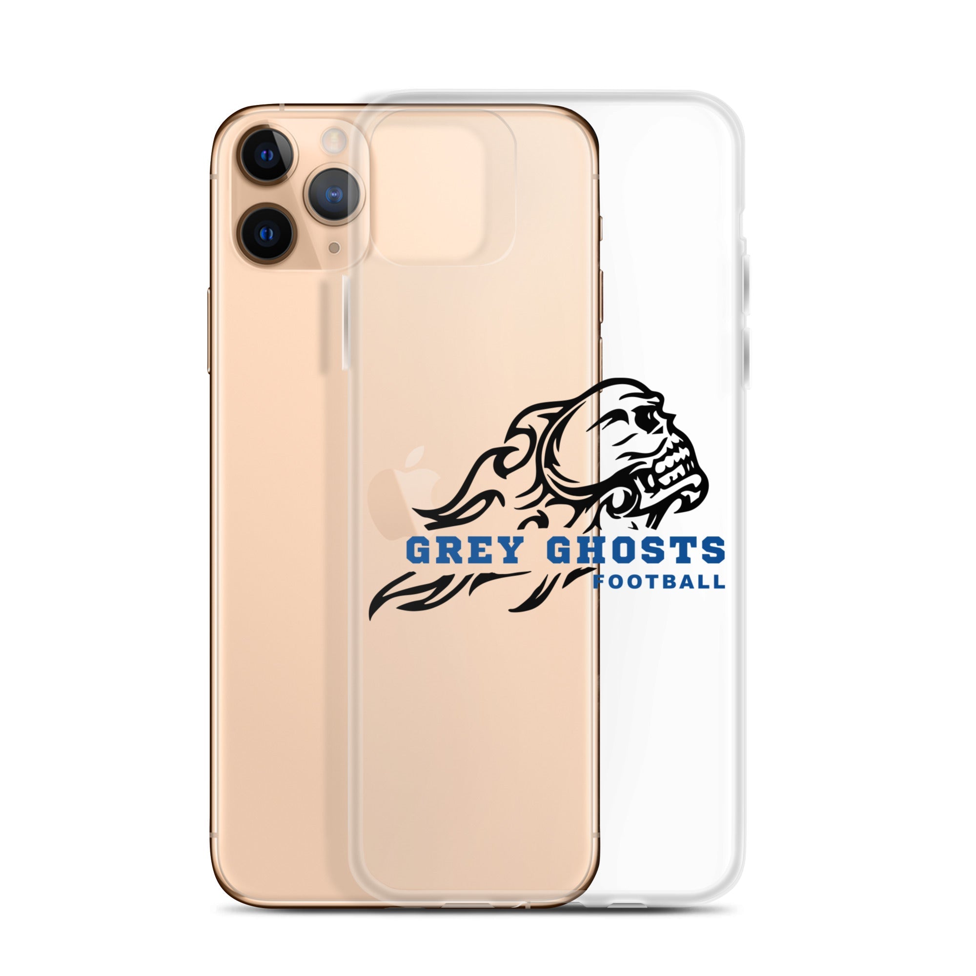 SM FB iPhone Case v3