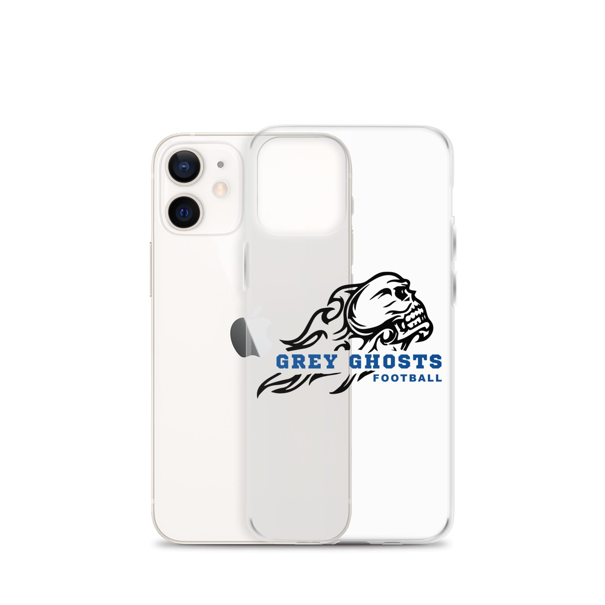 SM FB iPhone Case v3