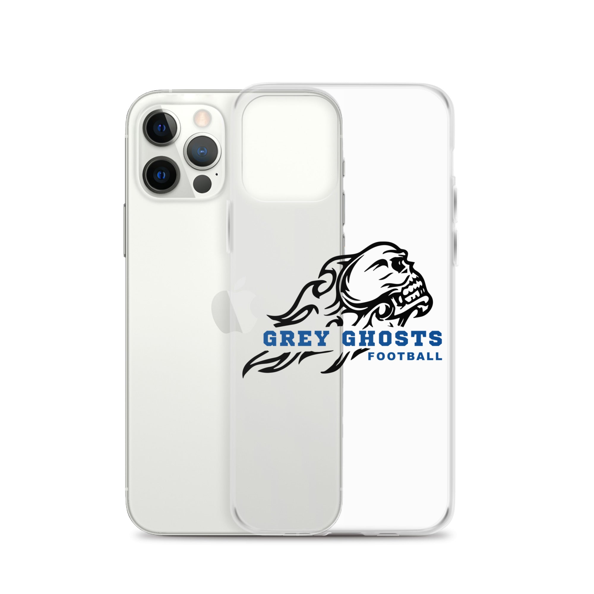 SM FB iPhone Case v3