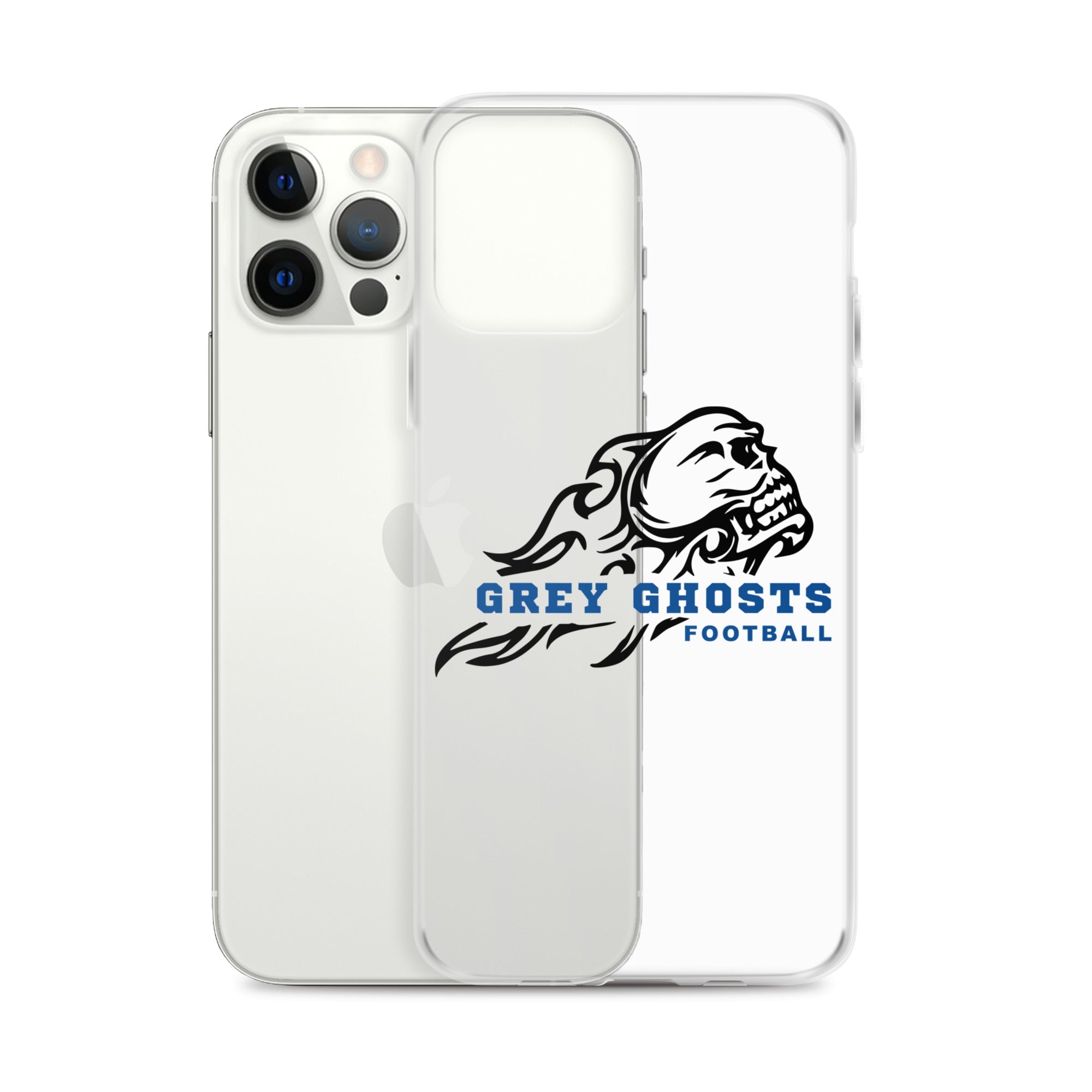 SM FB iPhone Case v3