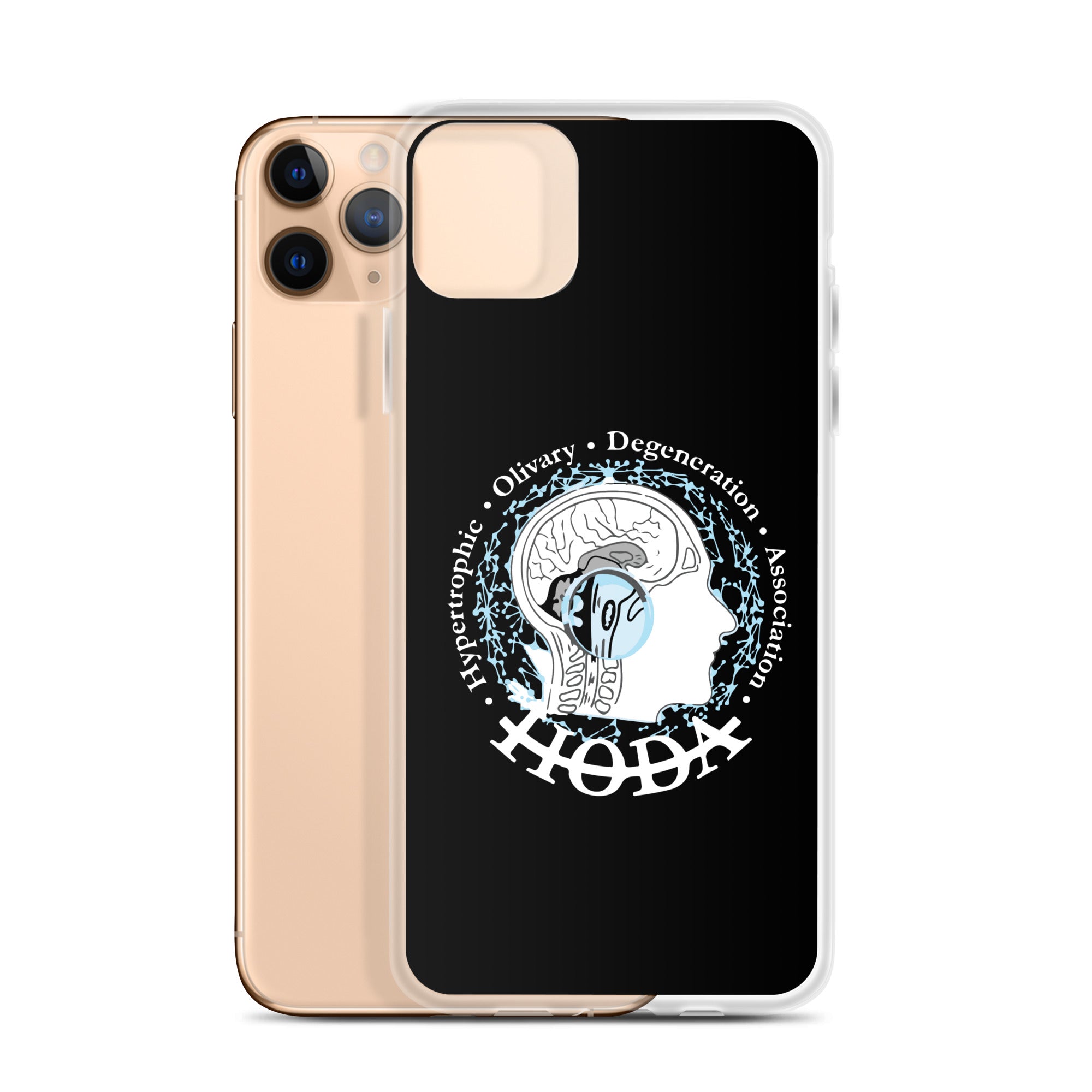 HODA Case for iPhone®