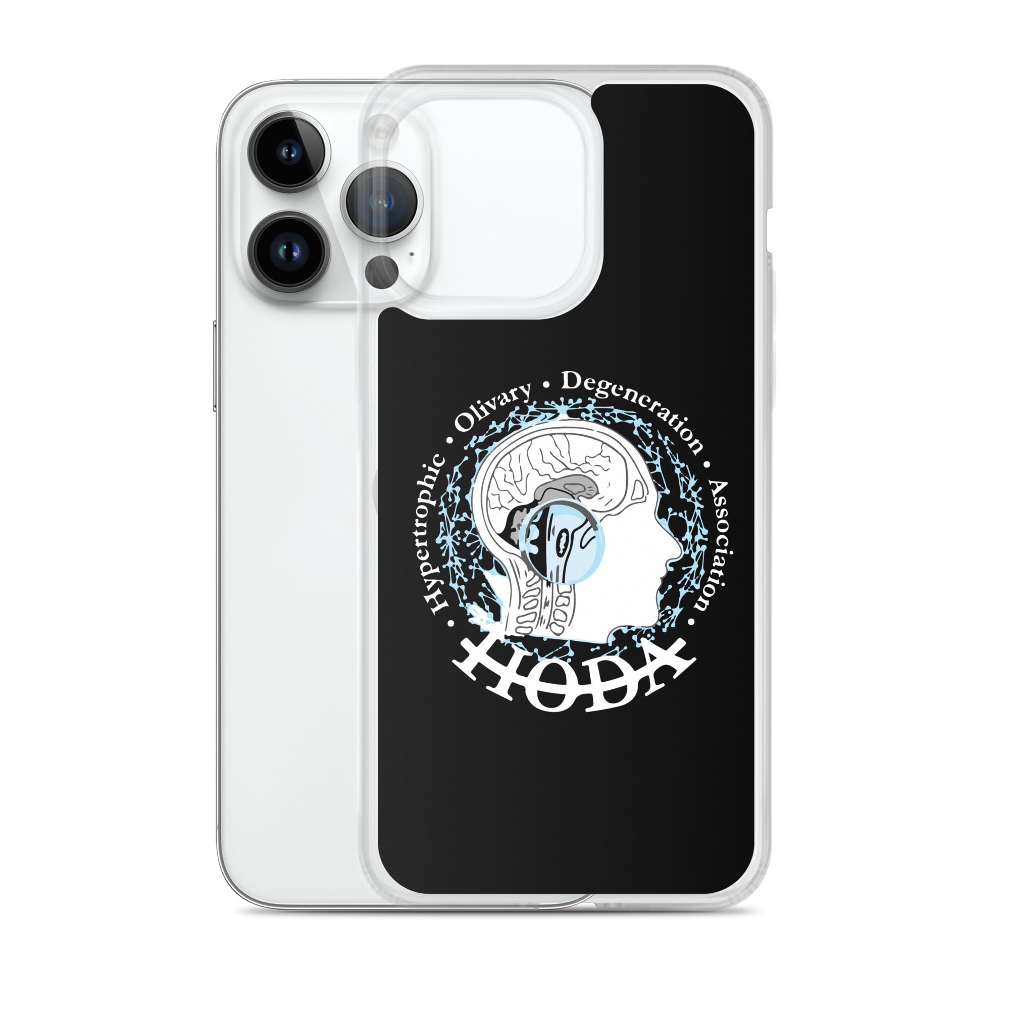 HODA Case for iPhone®